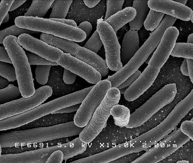 Escherichia coli bacteria 